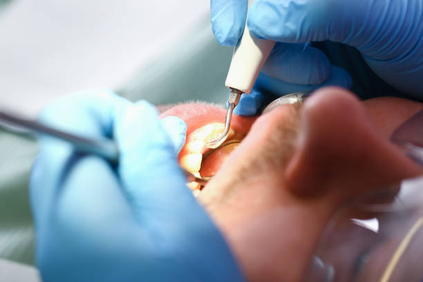 Best Weekend Emergency Dentist in Bluffton, IN