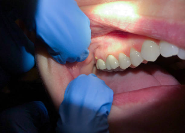 Best Orthodontic Emergency Dentist in Bluffton, IN