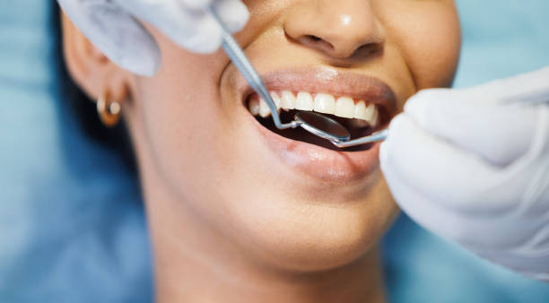 Best Broken or Cracked Tooth Emergency Dentist in Bluffton, IN