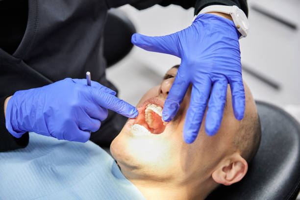 Best Broken or Cracked Tooth Emergency Dentist in Bluffton, IN